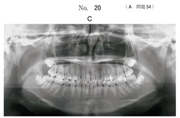 歯科矯正学 | 歯科国試ドットコム