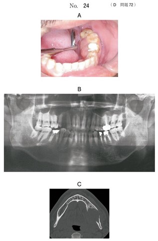 口腔内写真、エックス線画像、CT