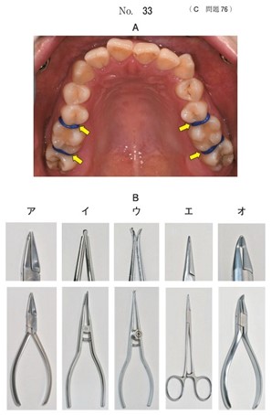 矯正装置装着前の口腔内写真と歯科治療で用いる器具の写真