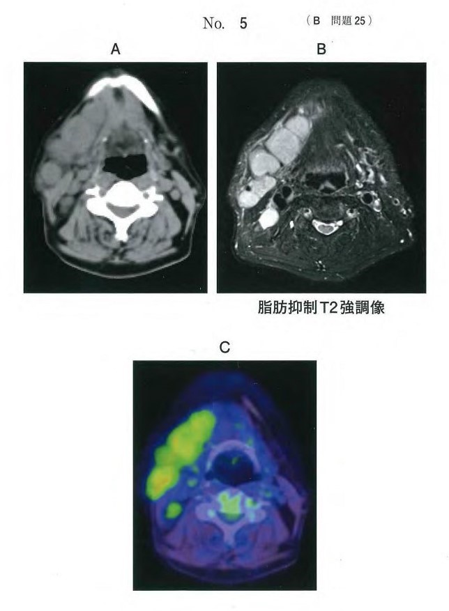 CT、MRI、FDG-PETCT写真