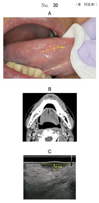 口腔内写真、造影CT、口腔内超音波検査の画像