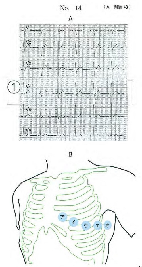 誘導心電図波形(胸部誘導)と胸部の模式図