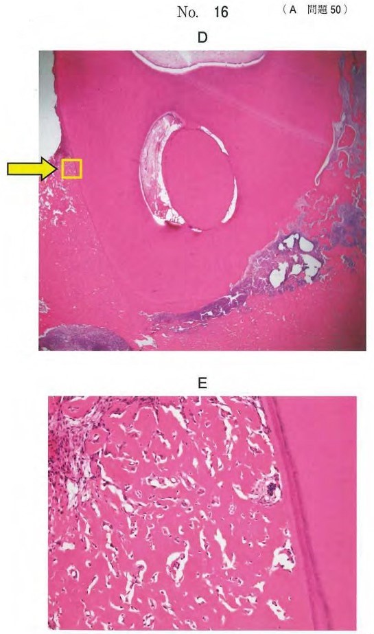 H-E染色病理組織像及び矢印で示す部分の拡大像