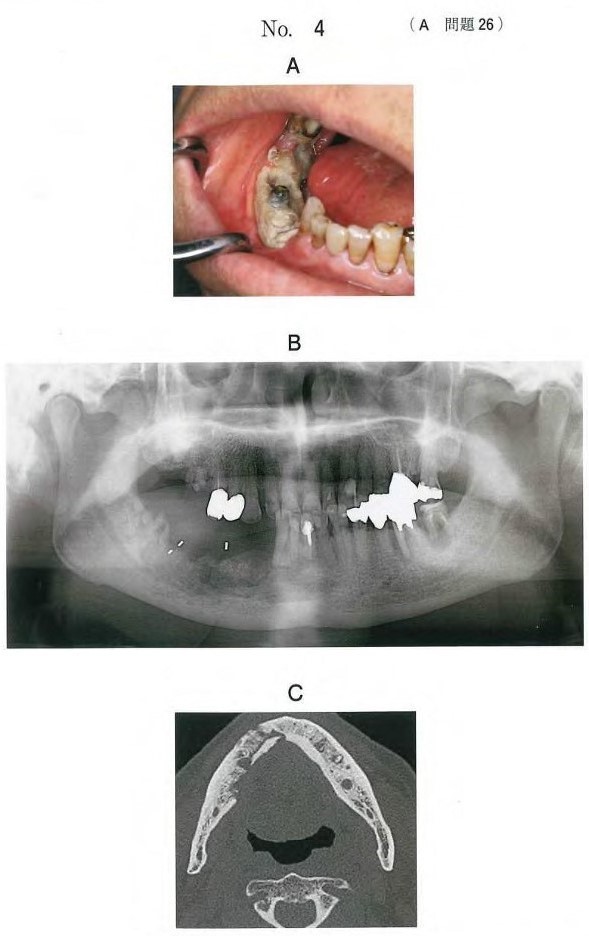 口腔内写真、 エックス線画像、CT