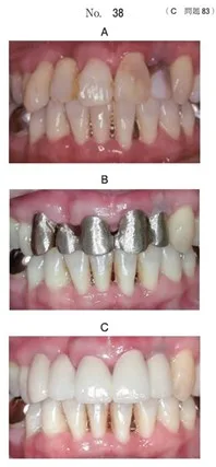 歯科医師国家試験 第114回 C83問題 | 歯科国試ドットコム