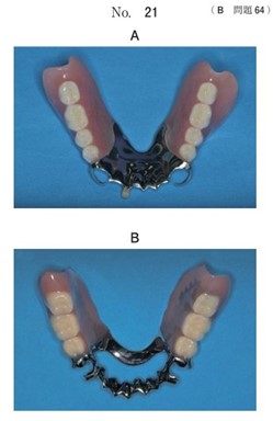設計の異なる下顎義歯の写真