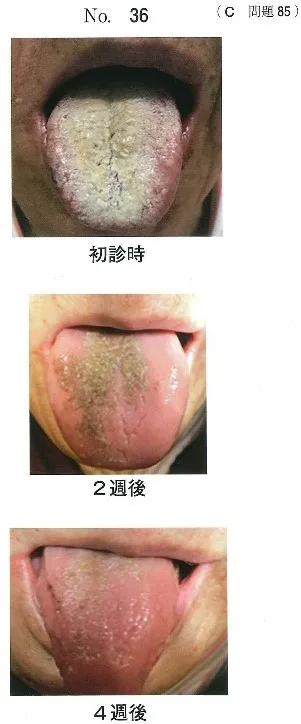 歯科医師国家試験 第116回 C85問題 | 歯科国試ドットコム