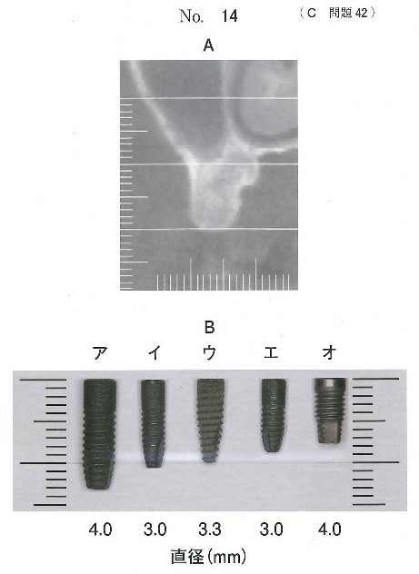 CT冠状断像と各種インプラント体の写真