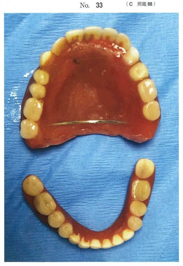 上下顎全部床義歯の写真
