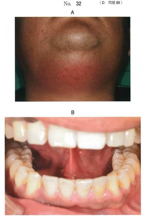 顔貌写真と口腔内写真