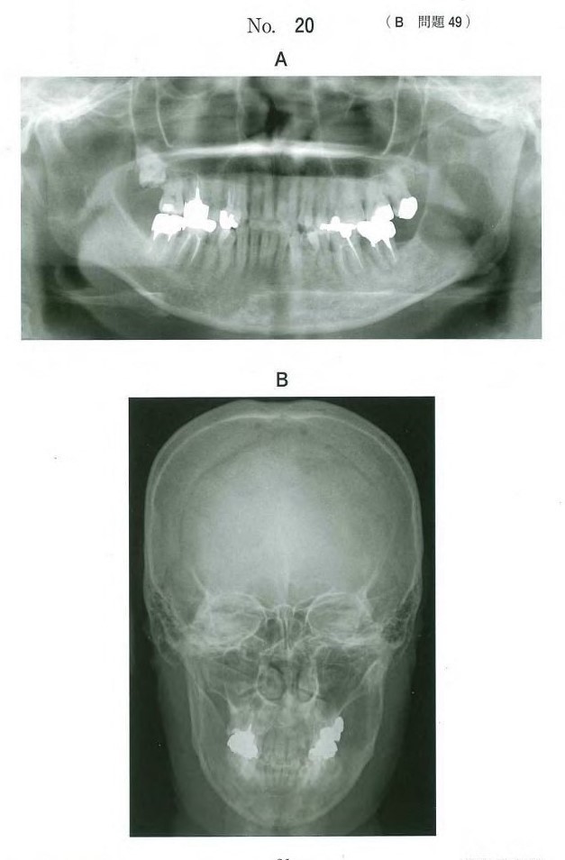 初診時のパノラマエックス線画像、頭部後前方向撮影エックス線画像