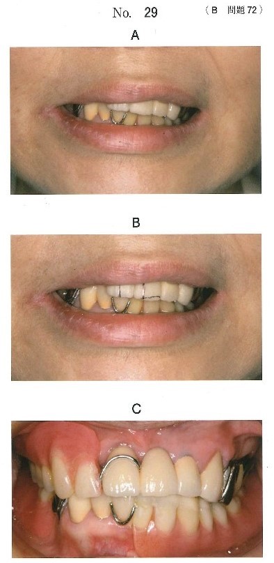 口元の写真、診察中に治療の参考となる補助線を記入した写真及び治療後の口腔内写真