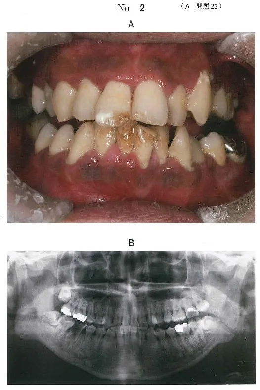 口腔外科学 | 歯科国試ドットコム