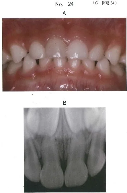 歯科医師国家試験 第116回 C64問題 | 歯科国試ドットコム