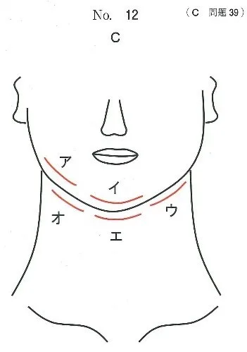 切開部位の模式図