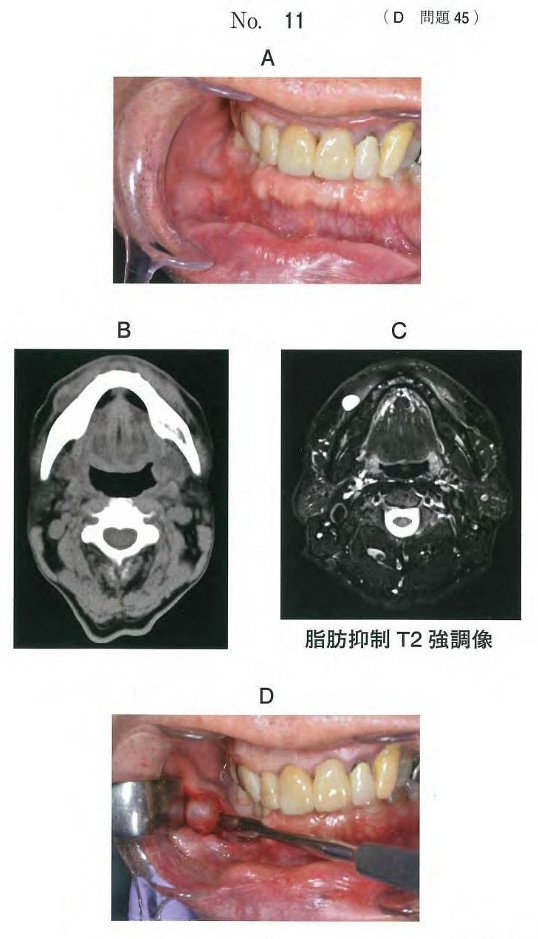 口腔内写真、CT、MRI、術中の口腔内写真