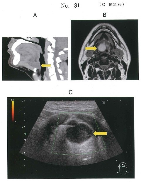 患者のCT、MRI T2強調像、及び超音波検査の冠状断像