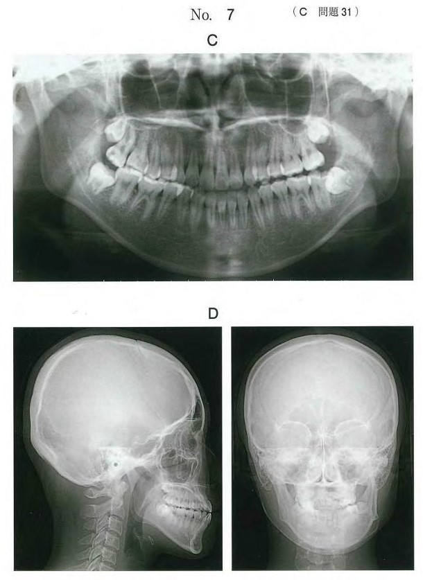 パノラマエックス線画像及び側面と正面の頭部エックス線規格写真