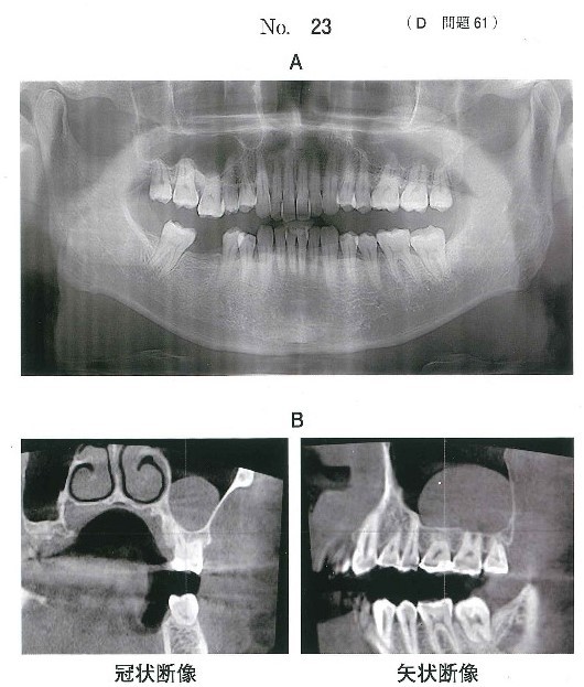 エックス線画像と歯科用コーンビームCT