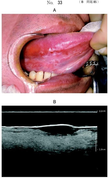 口腔内写真、口腔内超音波検査の画像
