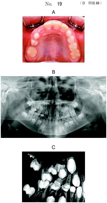 口腔内写真、エックス線画像及び3D-CT