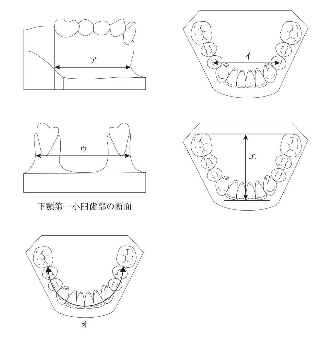 口腔模型の模式図