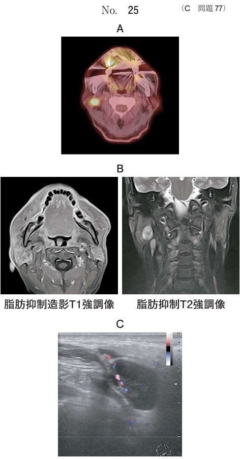 PET、CT、MRI脂肪抑制造影T1強調像と脂肪抑制T2強調像、ドプラ超音波横断像