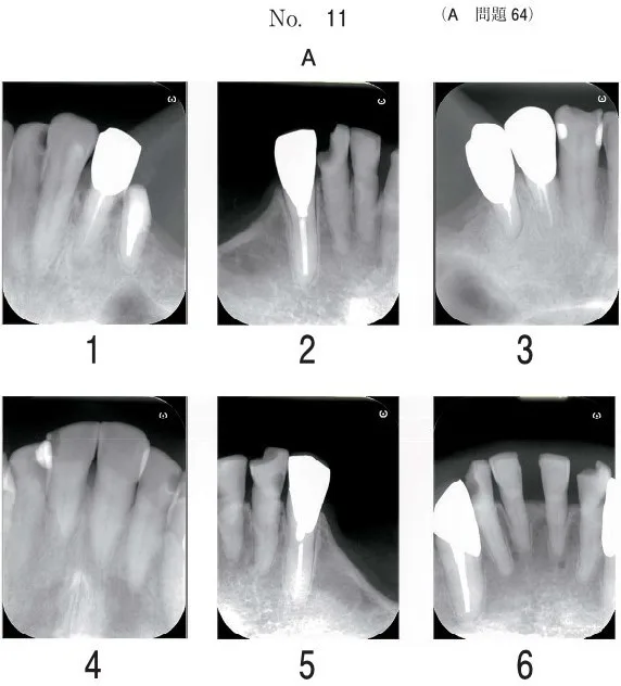 歯科放射線学 第6版 51guLeiS53L._AC_UL210_SR210,