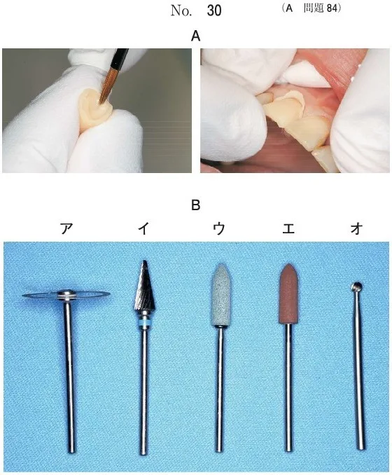 歯科医師国家試験 第112回 A84問題 | 歯科国試ドットコム