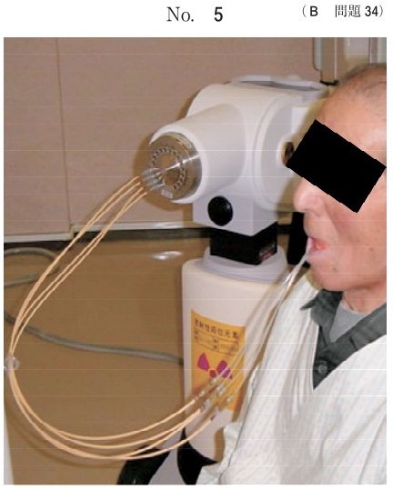 放射線治療時の写真