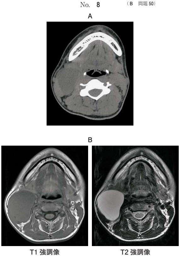 CT、MRI T1強調像およびT2強調像