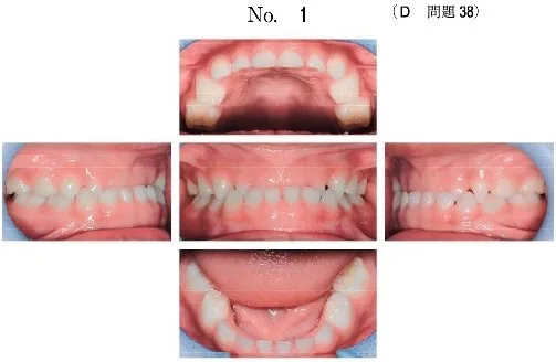 歯科医師国家試験 小児歯科(送料430円込) 小児歯科学 | 歯科国
