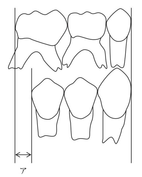 乳歯側方歯群と後継永久歯の関係の模式図