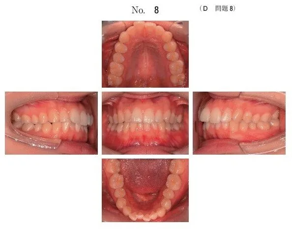 歯科矯正学 歯科矯正学 | 歯科国試ドットコム