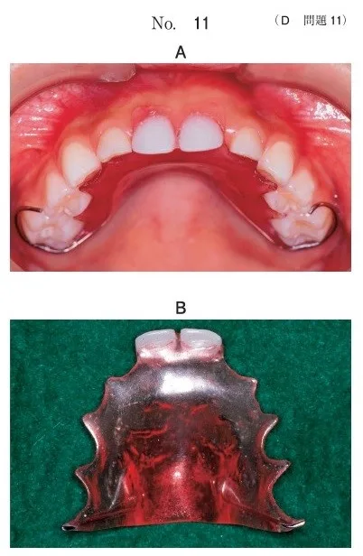 小児歯科学 | 歯科国試ドットコム