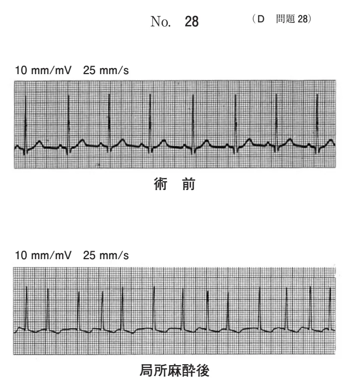 歯科麻酔学 | 歯科国試ドットコム