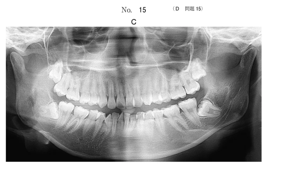 歯科矯正学 歯科矯正学 | 歯科国試ドットコム