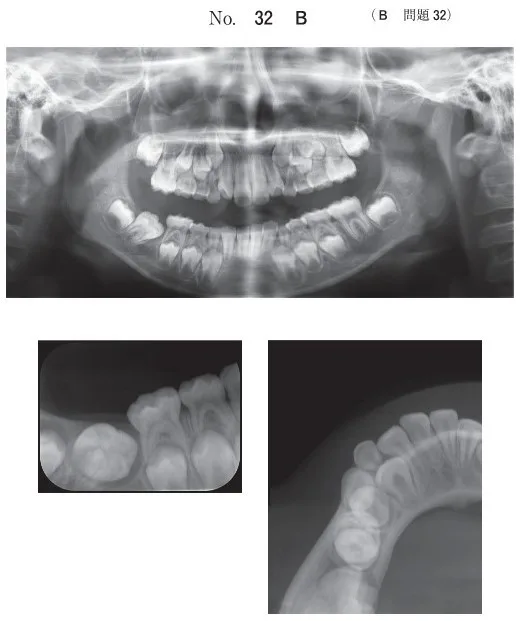歯科医師国家試験 第108回 B32問題 | 歯科国試ドットコム