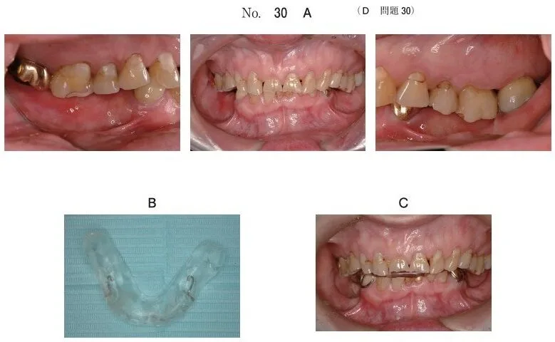 歯科医師国家試験 第108回 D30問題 | 歯科国試ドットコム