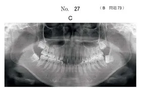 歯科矯正学 歯科矯正学 | 歯科国試ドットコム