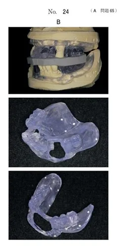 歯科医師国家試験 第117回 A65問題 | 歯科国試ドットコム