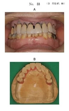 歯科医師国家試験 第117回 D88問題 | 歯科国試ドットコム