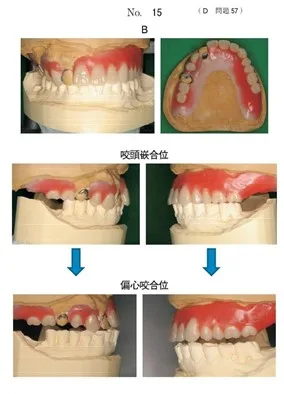 ANSER 歯科医師国家試験 第115回歯科医師国家試験問題解説書 | DES歯学教育スクール |本 | 通販