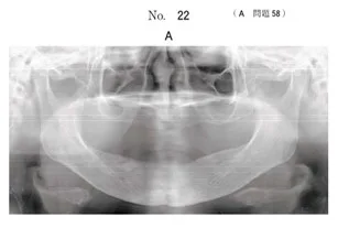 初診時のエックス線画像