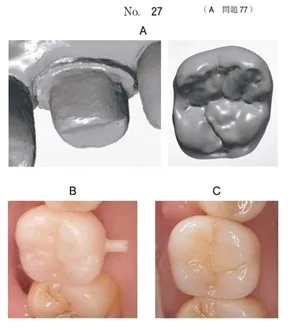 歯科医師国家試験 第117回 A77問題 | 歯科国試ドットコム