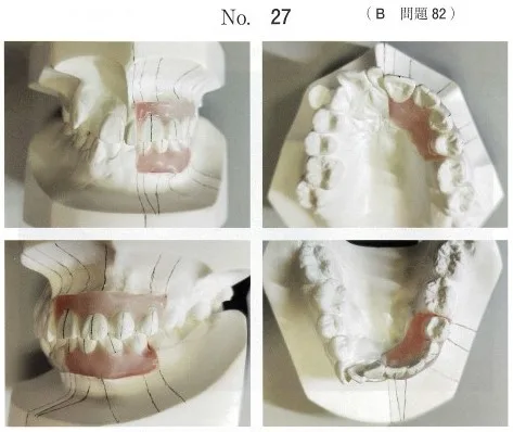歯科医師国家試験 第118回 B82問題 | 歯科国試ドットコム