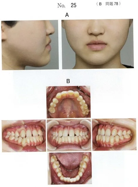 歯科矯正学 | 歯科国試ドットコム