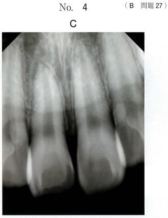 エックス線画像(別冊No.4C)